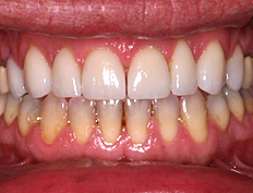 after image